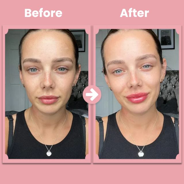 LushLips Roller Kit