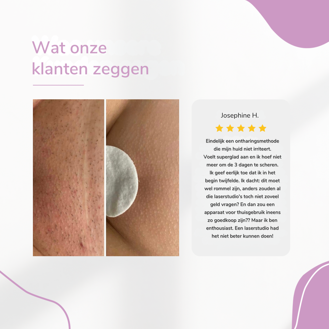LysaSkin™ – Pijnloos glad, permanent zelfverzekerd