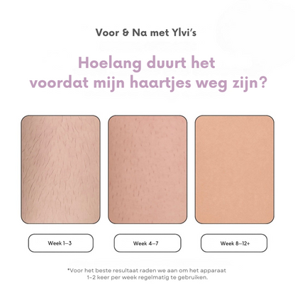 LysaSkin™ – Pijnloos glad, permanent zelfverzekerd