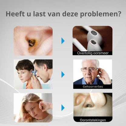 EarView Smart – Geavanceerde Oorreiniging met HD-Camera