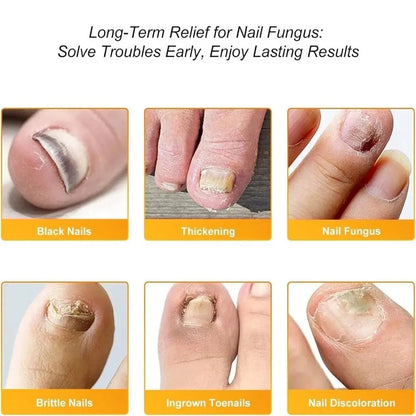FungalPatch - Antibacterieel Schimmelwerend Patch En Nagelverzorging Pak