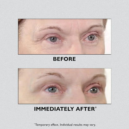 Instant Eye Lift Pro