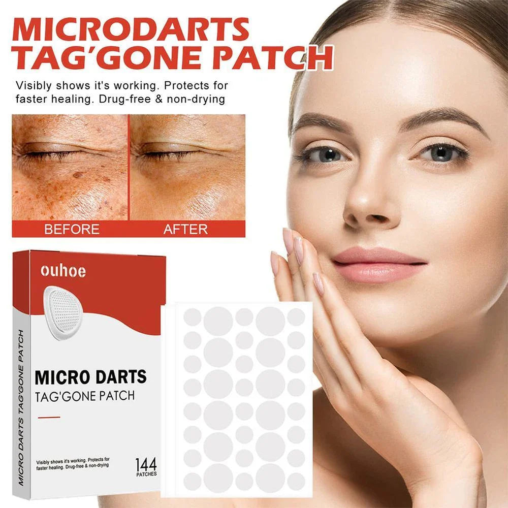 DermaDot™ MicroDarts – Pijnvrije verwijdering van huidaanhangsels