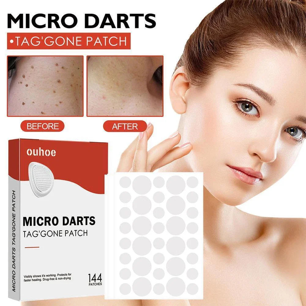 DermaDot™ MicroDarts – Pijnvrije verwijdering van huidaanhangsels