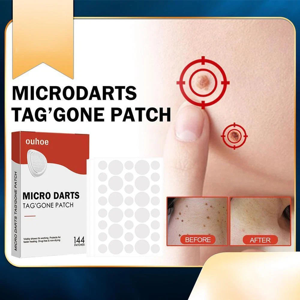 DermaDot™ MicroDarts – Pijnvrije verwijdering van huidaanhangsels